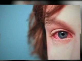 Effective Ways In Using Natural Allergy Remedies