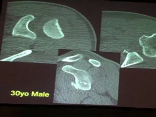 ESHED Rheumatologic Cases