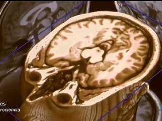 Cerebro: La formula matematica