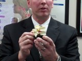 Bloomington IL Chiropractor Discusses Pinched Nerves