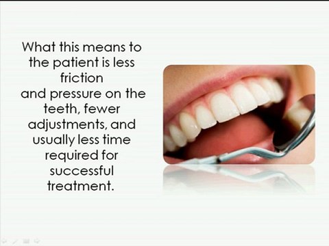 Self-Ligating Braces Orthodontists in Grand Rapids