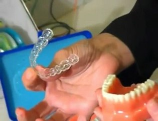 Manhattan Orthodontist Dr. Janet Stoess-Allen Speaks about Invisalign