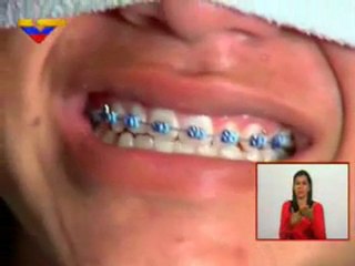 Reportaje Especial: Ortodoncia Chimba (Segunda Entrega)