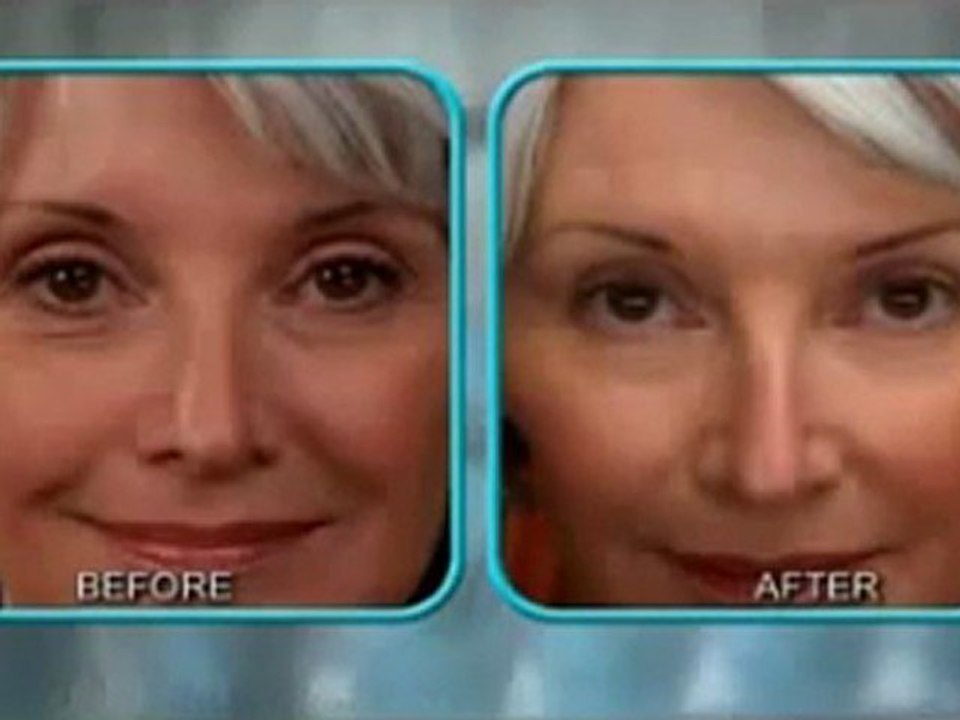 Buy Stem Cell Therapy Skin Cream and Reverse the Damaging Effects of Aging