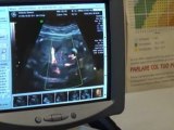 Poliambulatorio Valturio Rimini: ecografia tridimensionale in gravidanza