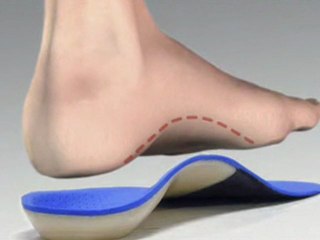 Custom Orthotics - Podiatrist Smithville, MO