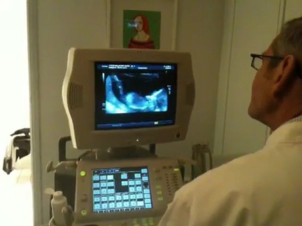 Echographie Popcorn 13SA 3/4