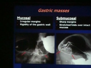 HILLER CONTRAST STUDY IN GI 2010