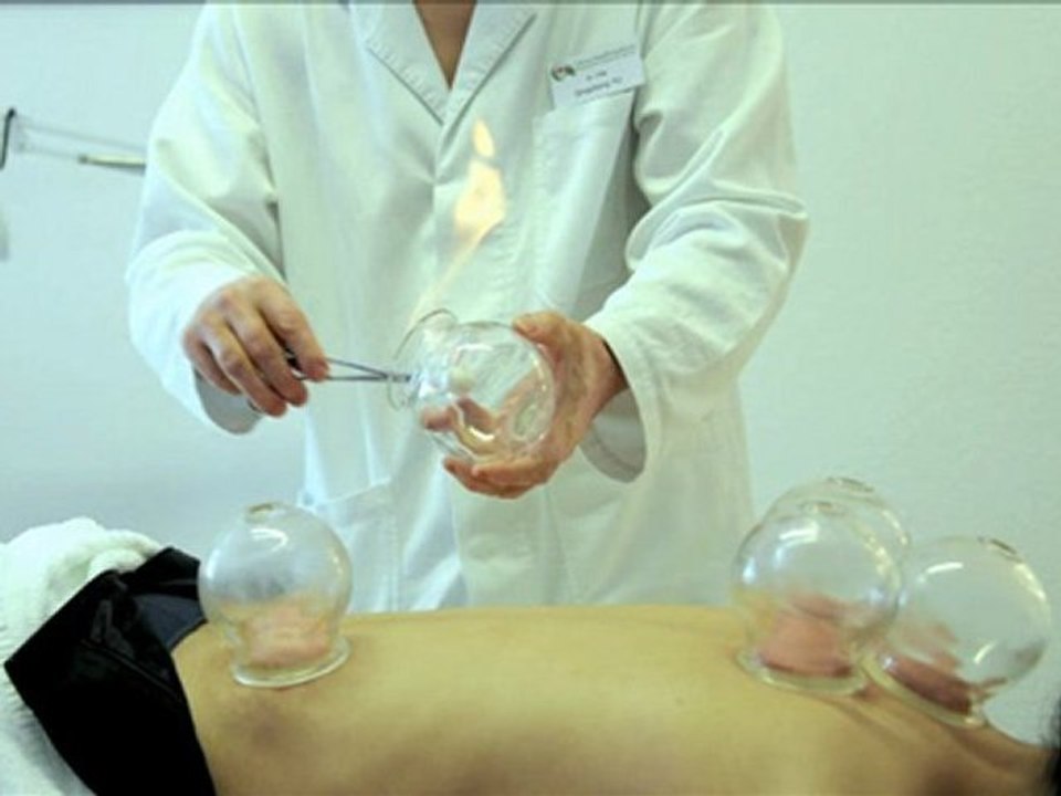 La médecine chinoiseالطب الصيني التقليدي