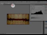 Diş Beyazlatma ( Videolu Anlatım )