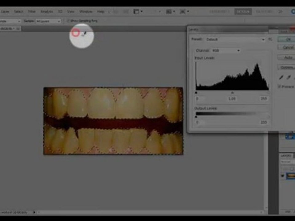Diş Beyazlatma ( Videolu Anlatım )
