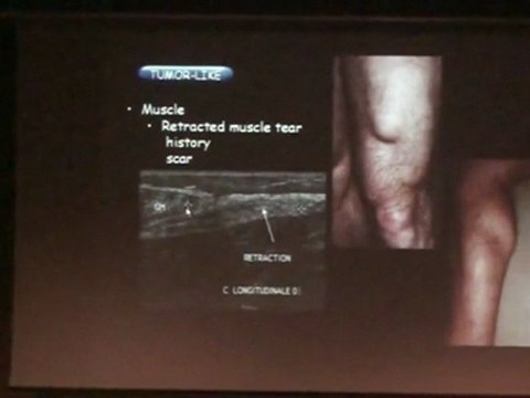 COHEN SOFT TISSUE MASS SONOGRAPHY 2010