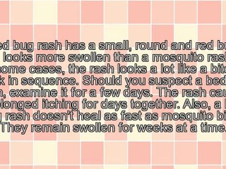 Doubt You Have Bed Bugs? Here Are 2 Clues