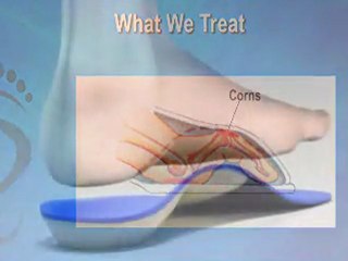 Chiropodist in Timmins, Cochrane and Kirkland Lake, ON - Rainville Chiropody