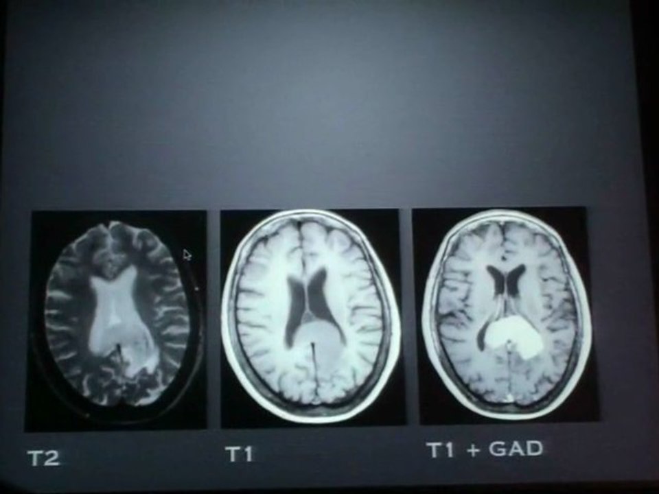 JONAS-KIMCHI Neuro-Oncology Imaging