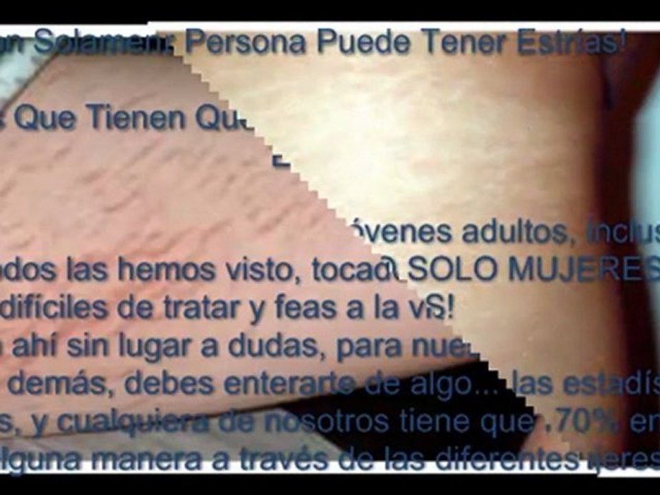 Eliminar estrías