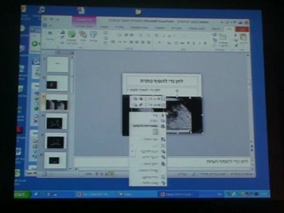 SKAIR-LEVY BREAST IMAGING CASES 2011