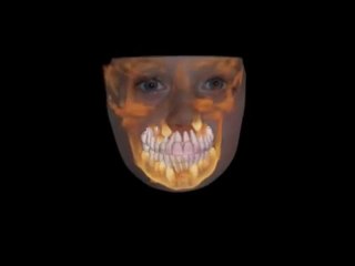Phoenix-Orthodontist-In-Peoria-AZ-offers-Advanced-3D-Technology-in-Treatment[www.savevid.com]