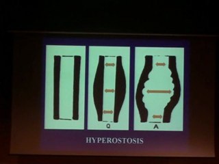 LAREDO BONE PSEUDO TUMORS Part 2 2010