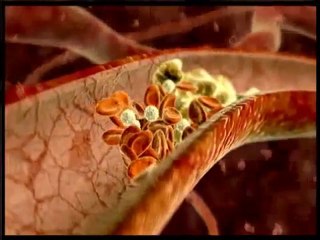 Dr. Michael D Moran, MD|South Orange County, CA Cardiologist