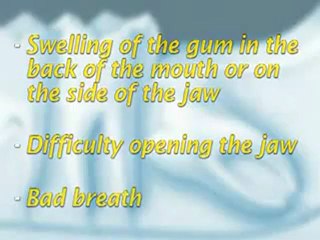 Extraction de dents de sagesse incluses