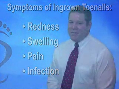 Ingrown Toenails - Podiatrist in Manahawkin, Barnegat, Little Egg Harbor, NJ