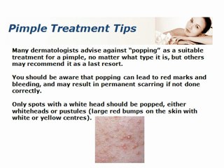 Pimple Treatment Tips For Your Skin