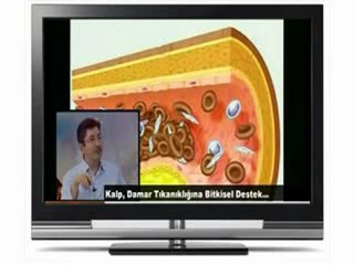 http://www.clavispanaxorjinal.net Kalp Damar Tıkanıklığına Bitkisel Destek - Clavis Panax