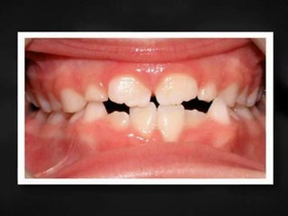 Orthodontics Aurora Nov2011