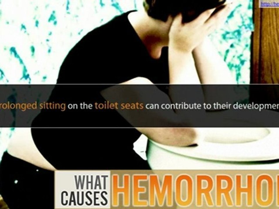 What Causes Hemorrhoids