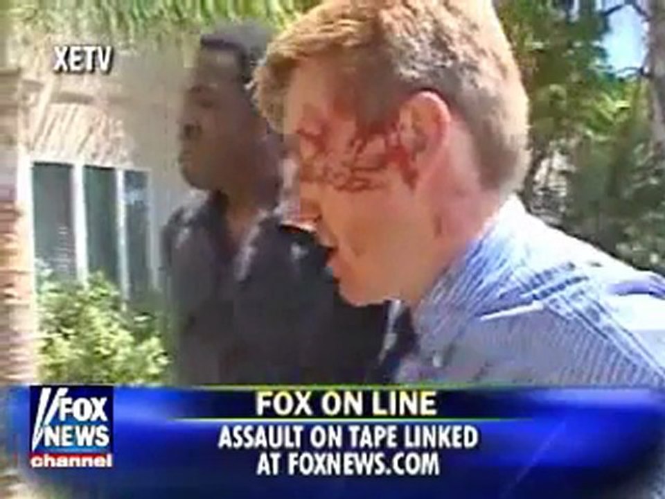 Fox News Reporter Attacked by Husband and Wife
