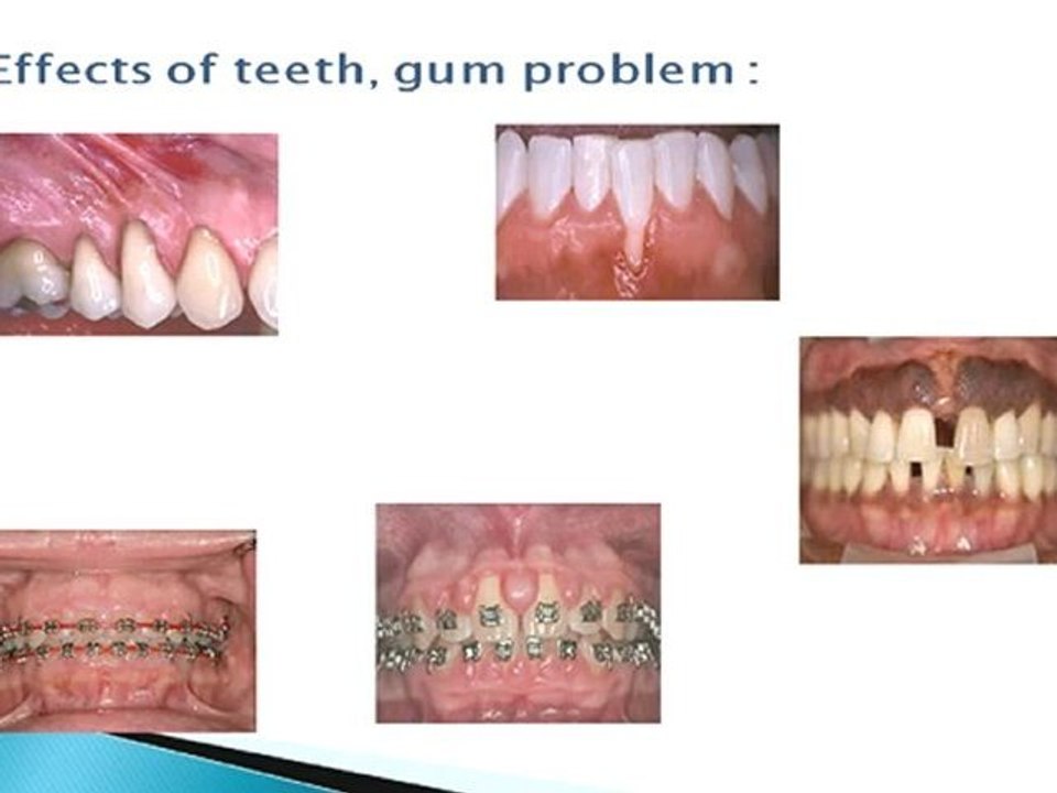 Los angeles dentist