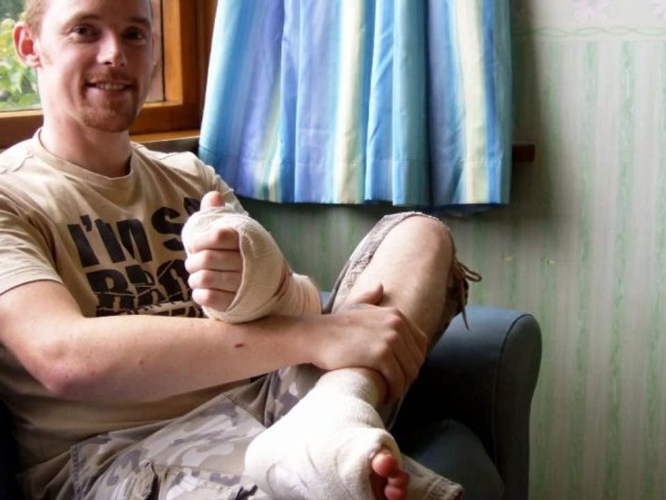 James Byrne et son gros orteil à la main