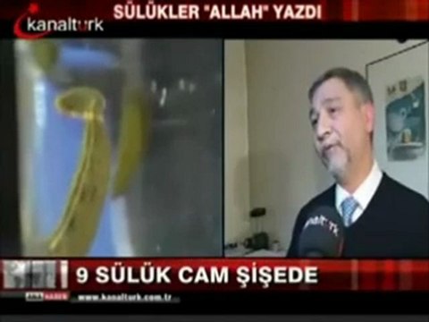 Sülükler Allah Yazdı-sülük tedavisi