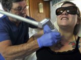 tattoo removal at home - natural tattoo removal - at home tattoo removal