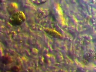 close to stentor ラッパムシに近い