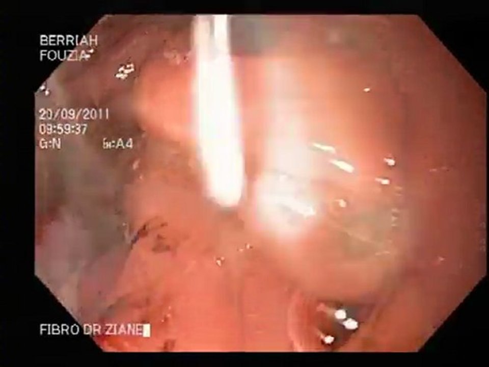 Endoscopie20.09.2011