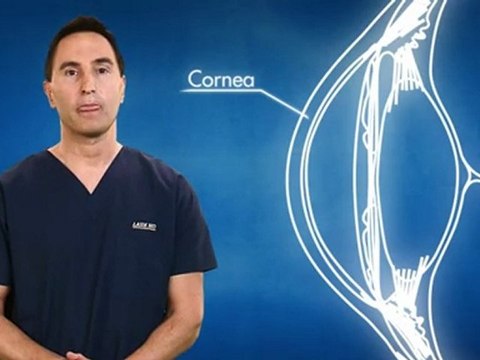 LASIK MD’s Dr. Mark Cohen explains “What is Laser Vision Correction”?