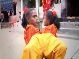 spider girls (conjoined twins)  - YouTube