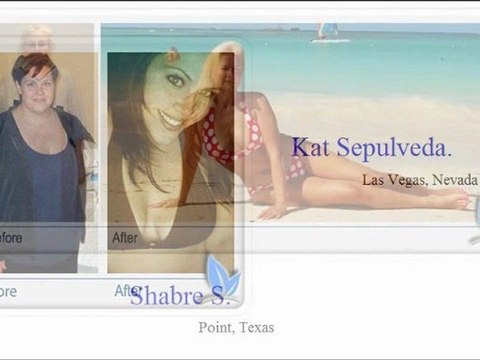 Sleeve Gastrectomy San Antonio TX