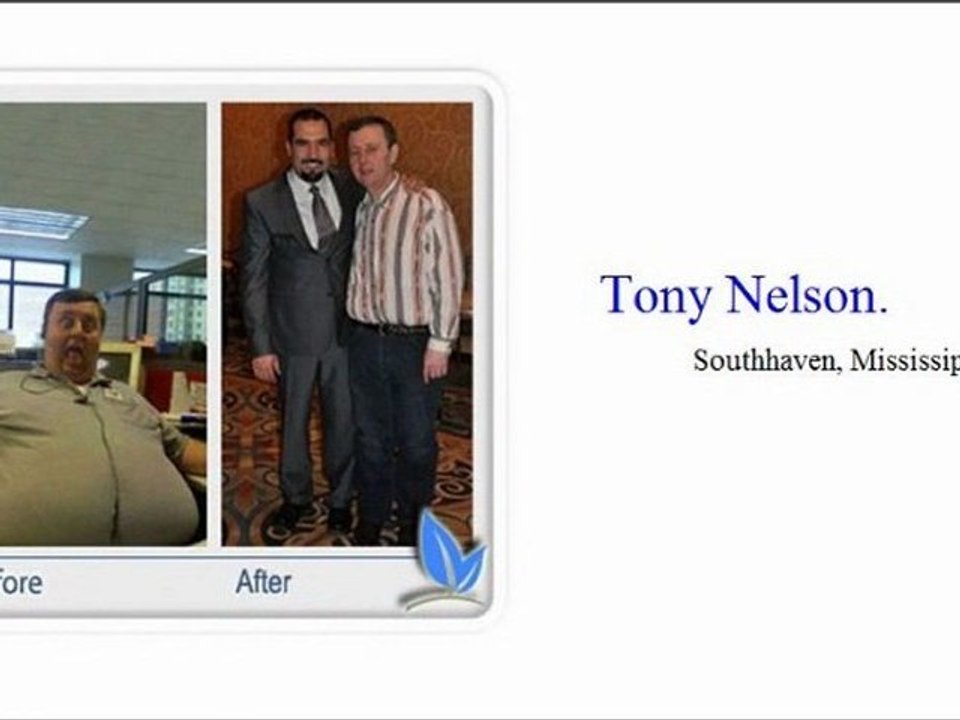 Weight Loss Surgeon San Antonio