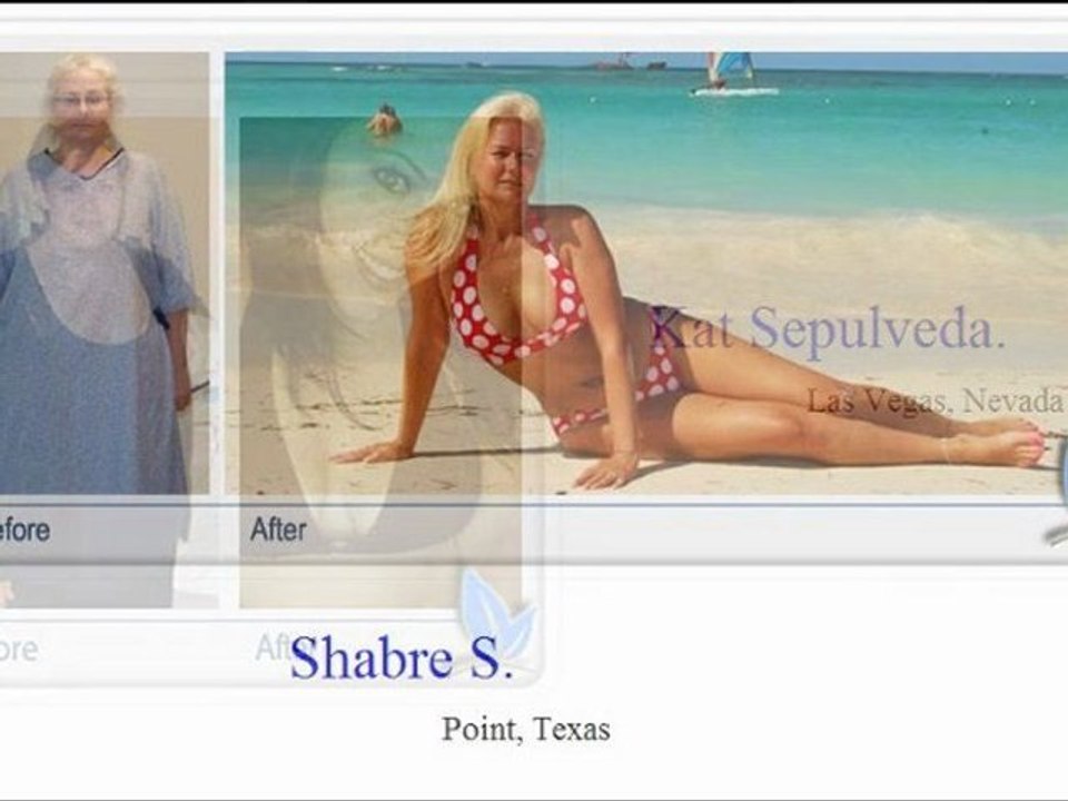 Bariatric Surgeon San Antonio TX