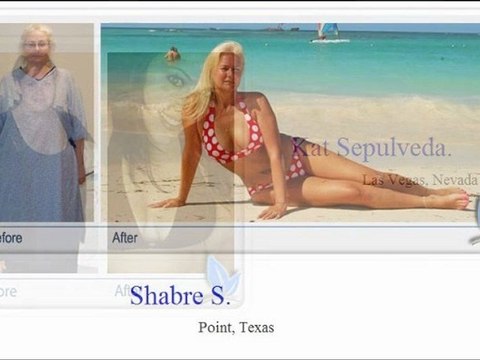 Bariatric Surgeon San Antonio TX