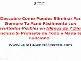 Como Eliminar el Acne *EL SECRETO*