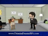 Everett WA Sedation Dentist on Tooth Sealants, Dental Office 98203, 98205