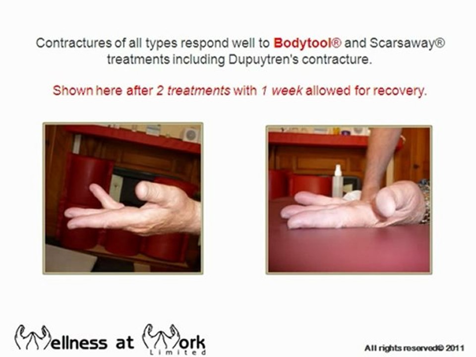 Wellness at Work Article-Video_1