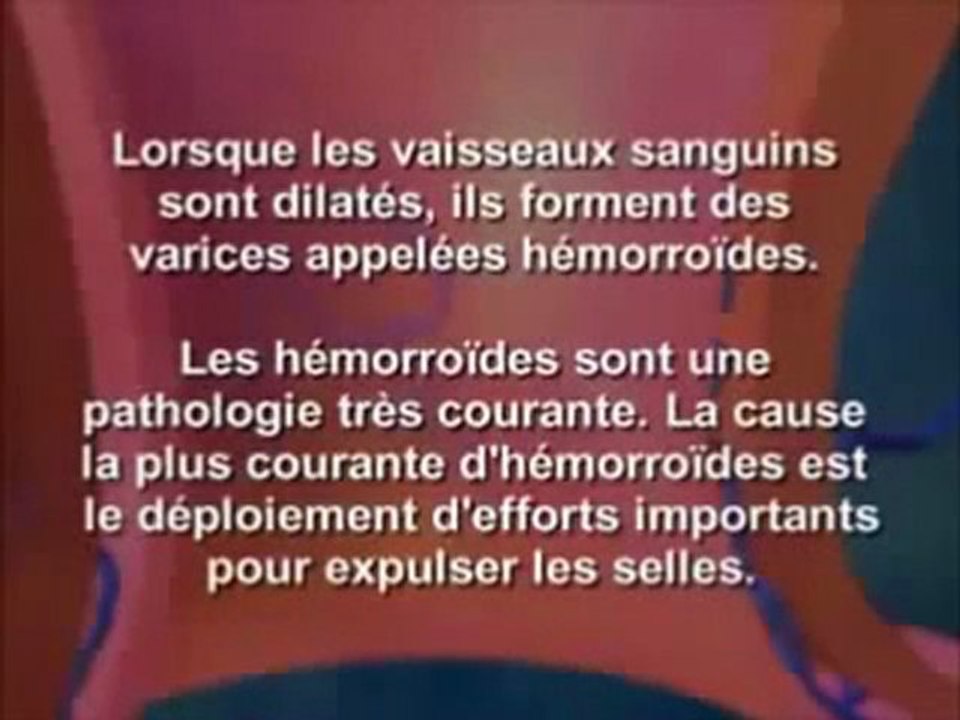 Comment se soigner rapidement! de manière naturelle de hémorroidaire
