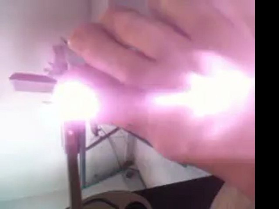 onychomycose ,champigons des ongles traités laser