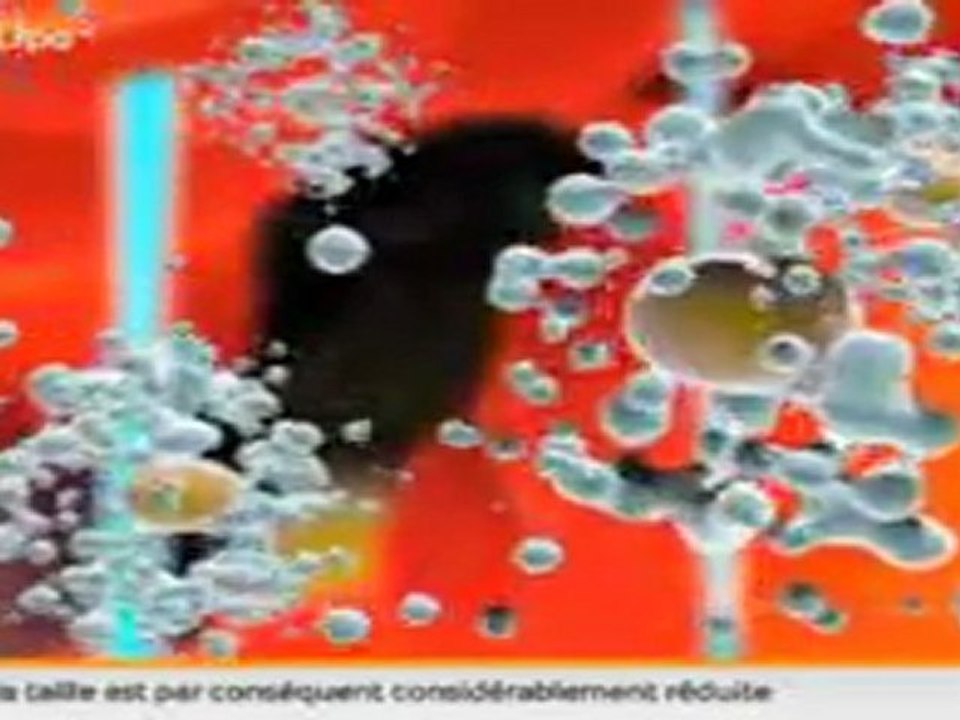 trilipo radiofrequence tripolaire remise en tension de la peau