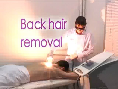 DERMEO Epilation par LUMIERE PULSEE